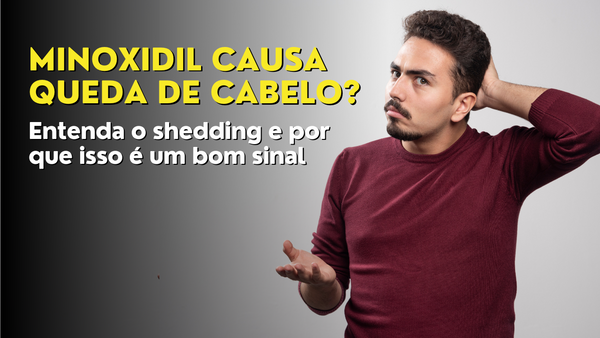Minoxidil Causa Queda de Cabelo? Entenda o Shedding e Por Que Isso é um Bom Sinal